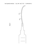 Shaped implantation device diagram and image