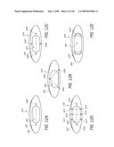 RAPID FLASH OPTICAL THERAPY diagram and image