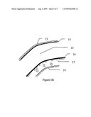 Resorbable Cornea Button diagram and image