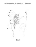 Nucleus implant and method of installing same diagram and image