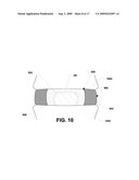 Nucleus implant and method of installing same diagram and image