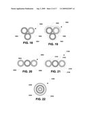 Nucleus implant and method of installing same diagram and image