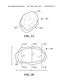 Articular Implants Providing Lower Adjacent Cartilage Wear diagram and image