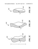 Articular Implants Providing Lower Adjacent Cartilage Wear diagram and image