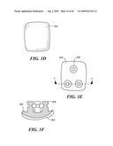 Articular Implants Providing Lower Adjacent Cartilage Wear diagram and image