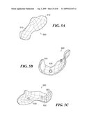 Articular Implants Providing Lower Adjacent Cartilage Wear diagram and image