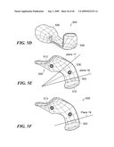 Articular Implants Providing Lower Adjacent Cartilage Wear diagram and image