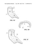 Articular Implants Providing Lower Adjacent Cartilage Wear diagram and image