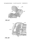 Articular Implants Providing Lower Adjacent Cartilage Wear diagram and image