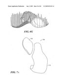 Articular Implants Providing Lower Adjacent Cartilage Wear diagram and image