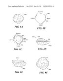 Articular Implants Providing Lower Adjacent Cartilage Wear diagram and image