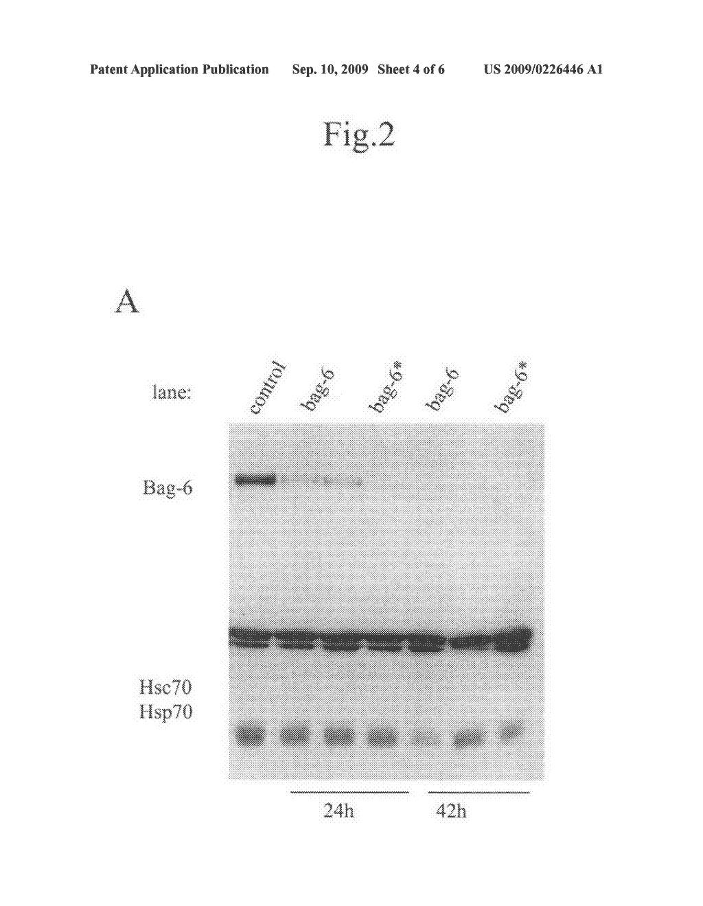 Method to Inhibit the Propagation of an Undesired Cell Population - diagram, schematic, and image 05