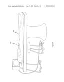 Fluoroscopy operator protection device diagram and image