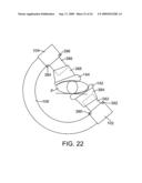 Fluoroscopy operator protection device diagram and image