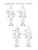 Fluoroscopy operator protection device diagram and image