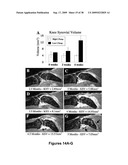 METHODS AND COMPOSITIONS FOR TREATING INFLAMMATORY CONDITIONS diagram and image