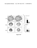 METHODS AND COMPOSITIONS FOR TREATING INFLAMMATORY CONDITIONS diagram and image