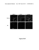 METHODS AND COMPOSITIONS FOR TREATING INFLAMMATORY CONDITIONS diagram and image