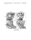 METHODS AND COMPOSITIONS FOR TREATING INFLAMMATORY CONDITIONS diagram and image