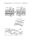 Filamentous Embolization Device With Expansible Elements diagram and image