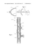 Apparatus and Method for Penetrating Oilbearing Sandy Formations, Reducing Skin Damage and Reducing Hydrocarbon Viscosity diagram and image