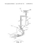 SECRETION CLEARING PATIENT AIRWAY MANAGEMENT SYSTEM diagram and image