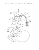 SECRETION CLEARING PATIENT AIRWAY MANAGEMENT SYSTEM diagram and image