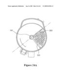 VACUUM CLEANER WITH REMOVABLE DUST COLLECTOR, AND METHODS OF OPERATING THE SAME diagram and image