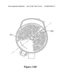 VACUUM CLEANER WITH REMOVABLE DUST COLLECTOR, AND METHODS OF OPERATING THE SAME diagram and image