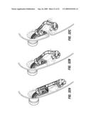 ENDOSCOPIC STAPLING DEVICES AND METHODS diagram and image