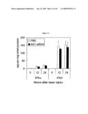 TOLL LIKE RECEPTOR (TLR) STIMULATION FOR OCULAR ANGIOGENESIS AND MACULAR DEGENERATION diagram and image