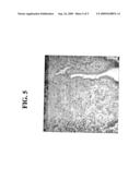 BISPHOSPHONATES FOR TREATING ENDOMETRIOSIS diagram and image