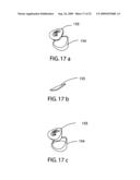 MUSCLE-BACK, WITH INSERT, IRON TYPE GOLF CLUB HEAD diagram and image