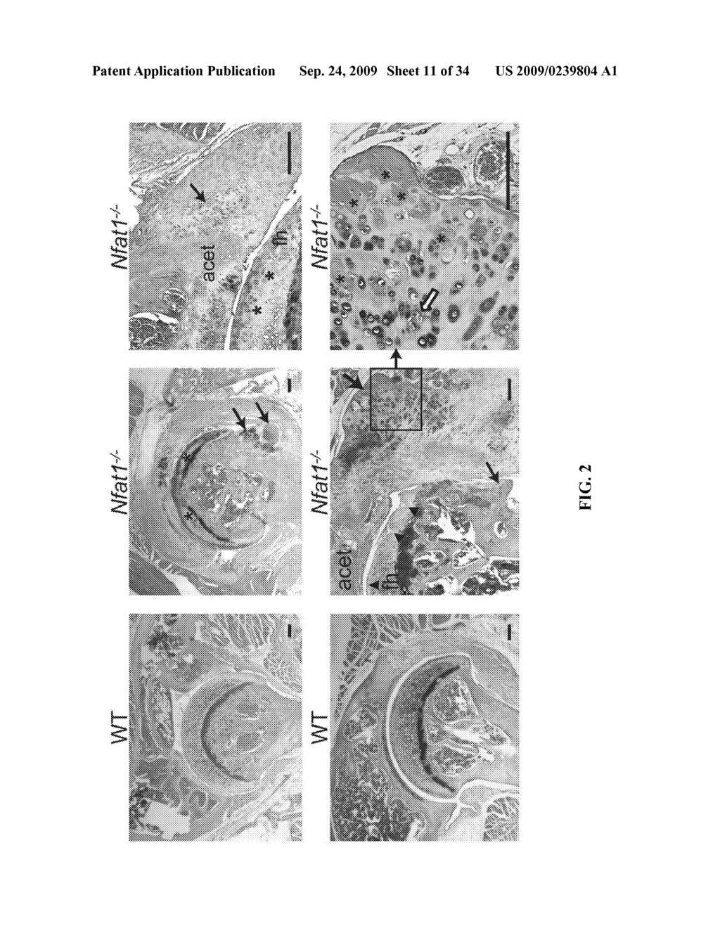 PREVENTION AND TREATMENT OF OSTEOARTHRITIS - diagram, schematic, and image 12