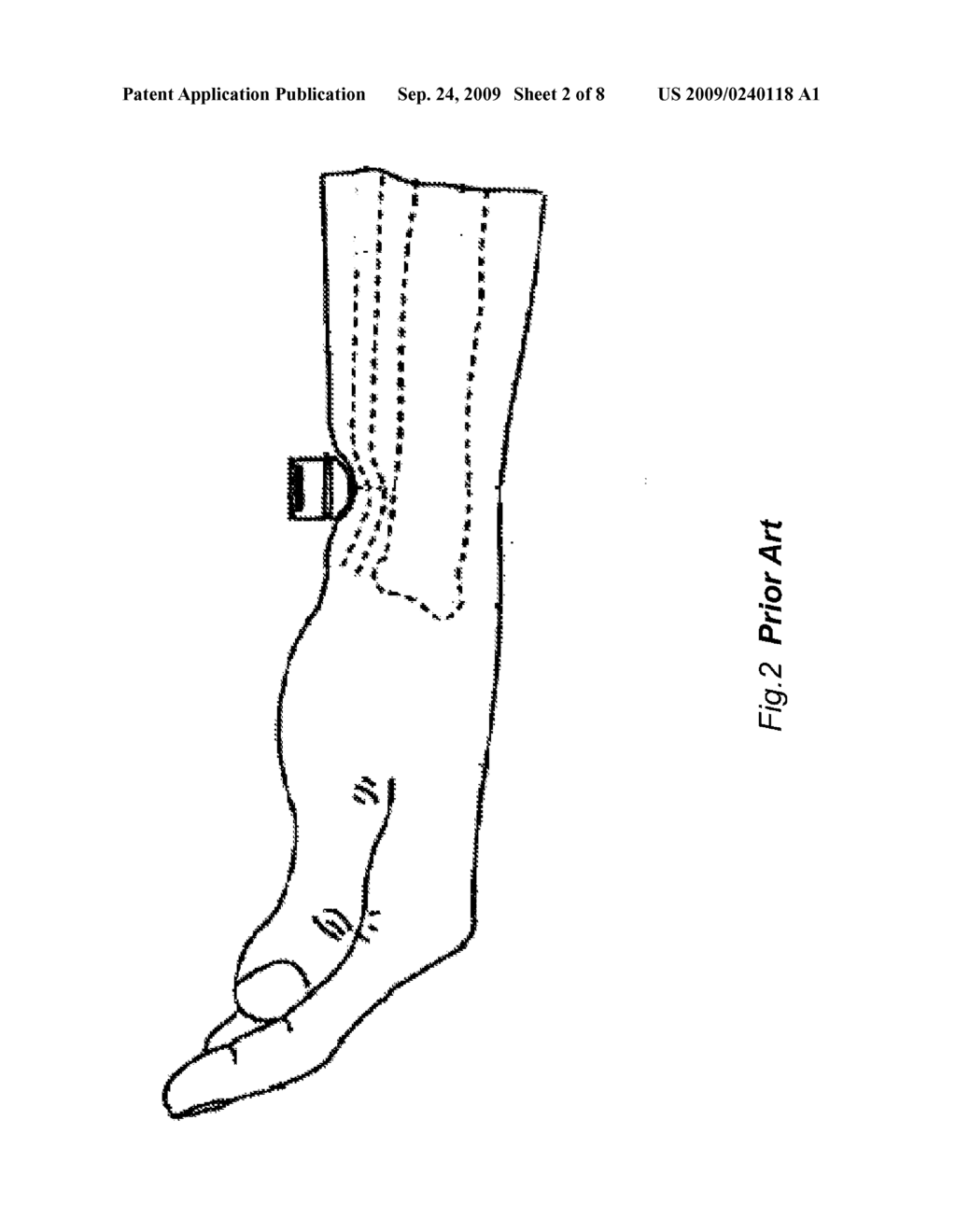 MOBILE DEVICE AND SYSTEM FOR MONITORING & RECORDING BODY VITAL SIGNS - diagram, schematic, and image 03