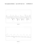 Method of processing thoracic reflected radio interrogation signals diagram and image