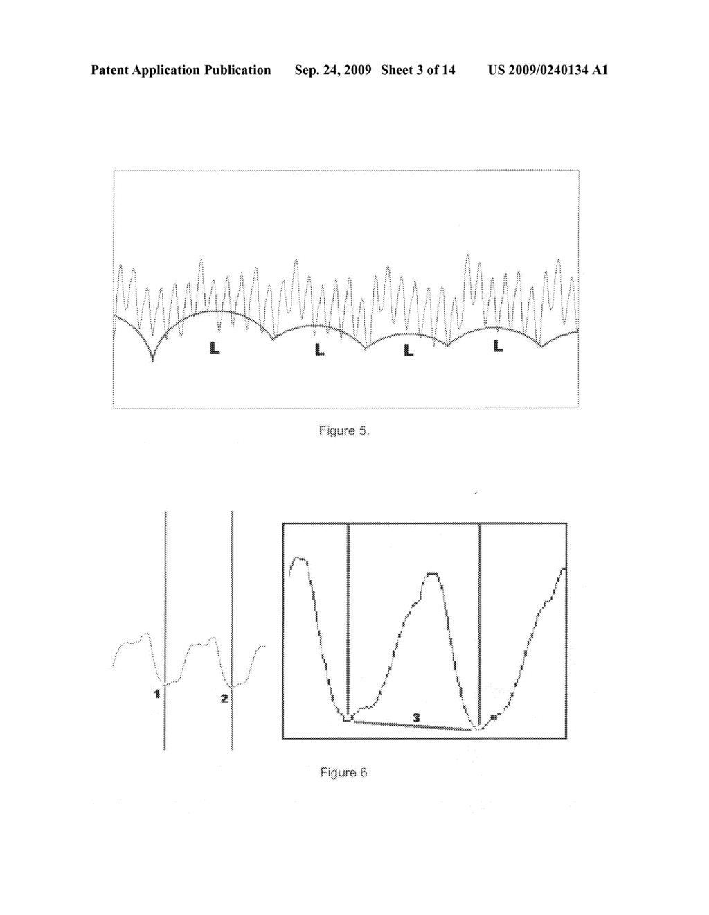 Method of processing thoracic reflected radio interrogation signals - diagram, schematic, and image 04