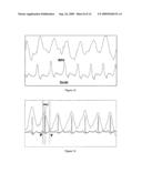 Method of processing thoracic reflected radio interrogation signals diagram and image