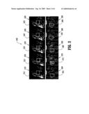 Contrast-invariant registration of cardiac and renal magnetic resonance perfusion images diagram and image