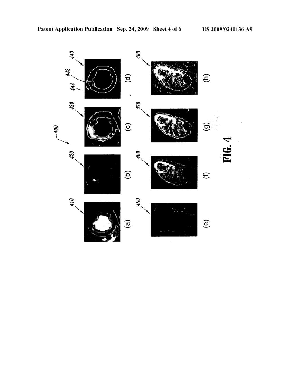 Contrast-invariant registration of cardiac and renal magnetic resonance perfusion images - diagram, schematic, and image 05