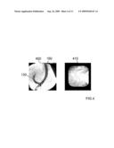 METHOD AND AN OPTICAL PROBE FOR IN VIVO IMAGING OF A MUCOSA IN A BILIARY OR PANCREATIC SYSTEM AND A METHOD FOR SELECTIVELY OPERATING A TISSUE SAMPLING OF A MUCOSA IN A BILIARY OR PANCREATIC SYSTEM diagram and image