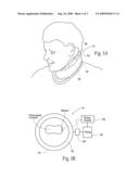 Devices, systems, and methods to fixate tissue within the regions of body, such as the pharyngeal conduit diagram and image