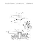 APPARATUS AND METHOD FOR ELECTRICALLY INDUCED THROMBOSIS diagram and image