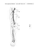 Device for affixing prosthesis to a vessel diagram and image