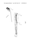 Device for affixing prosthesis to a vessel diagram and image