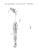 Device for affixing prosthesis to a vessel diagram and image