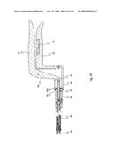 Device for affixing prosthesis to a vessel diagram and image