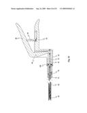 Device for affixing prosthesis to a vessel diagram and image