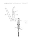 Device for affixing prosthesis to a vessel diagram and image