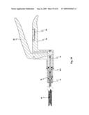 Device for affixing prosthesis to a vessel diagram and image